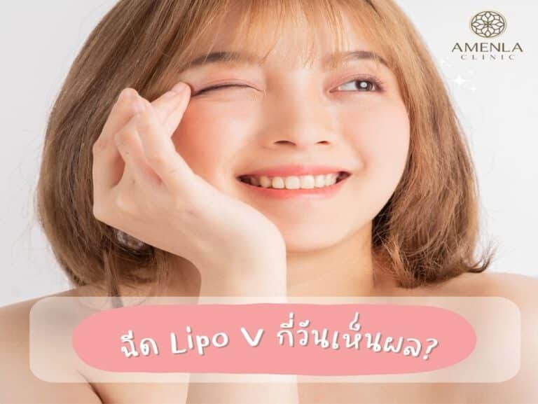 เมโสแฟต ไลโปวี กี่วันเห็นผล